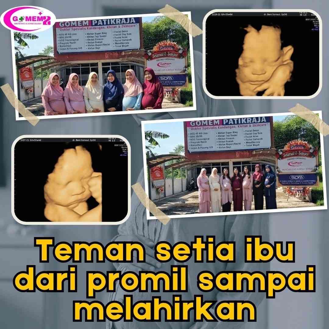 Banyak Ibu di Somagede Pilih USG Ini untuk Lebih Tenang