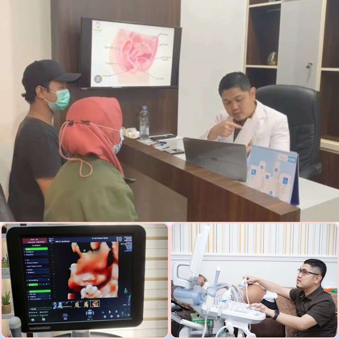 Biaya USG di Patikraja Banyumas Terbaru dan Terjangkau