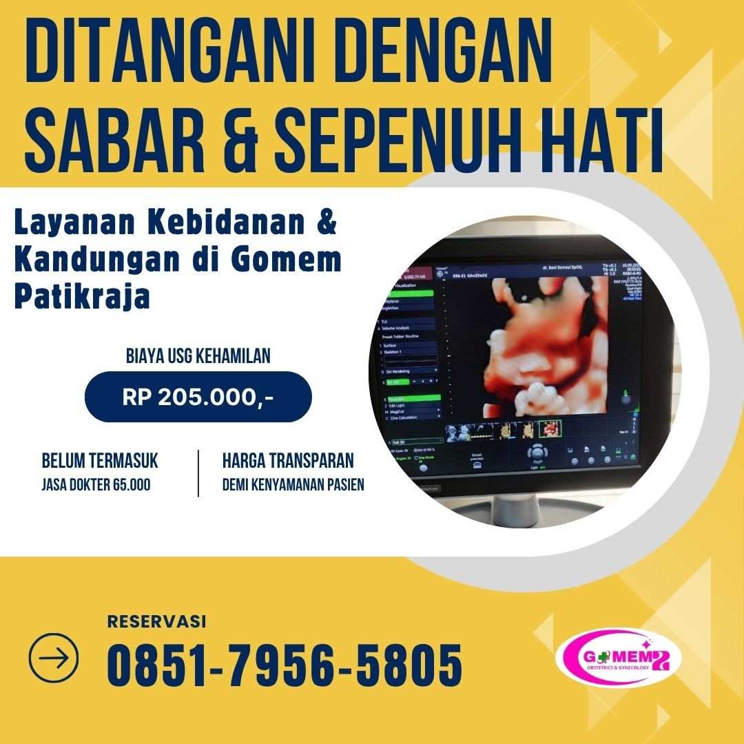 Bingung Mau USG dekat Purwokerto Barat? Ini Tempat yang Banyak Dipilih