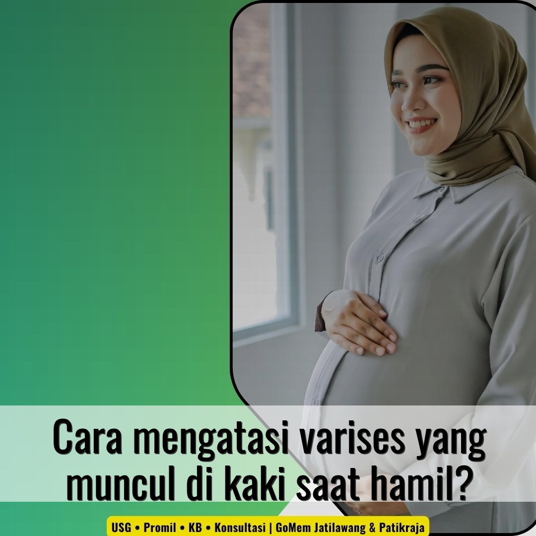 Cara mengatasi varises yang muncul di kaki saat hamil?