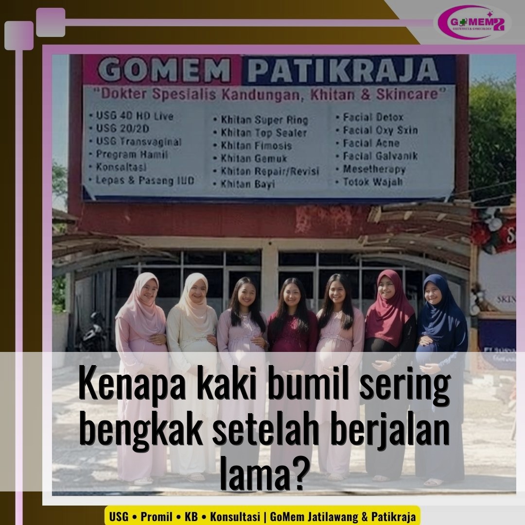 Kenapa kaki bumil sering bengkak setelah berjalan lama?
