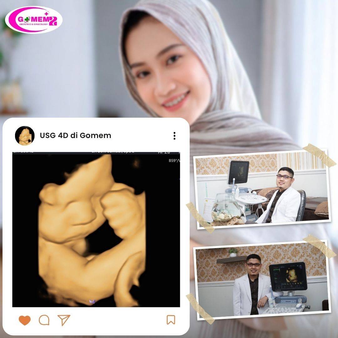 Lepas IUD dengan Proses Halus dekat Banyumas Kota