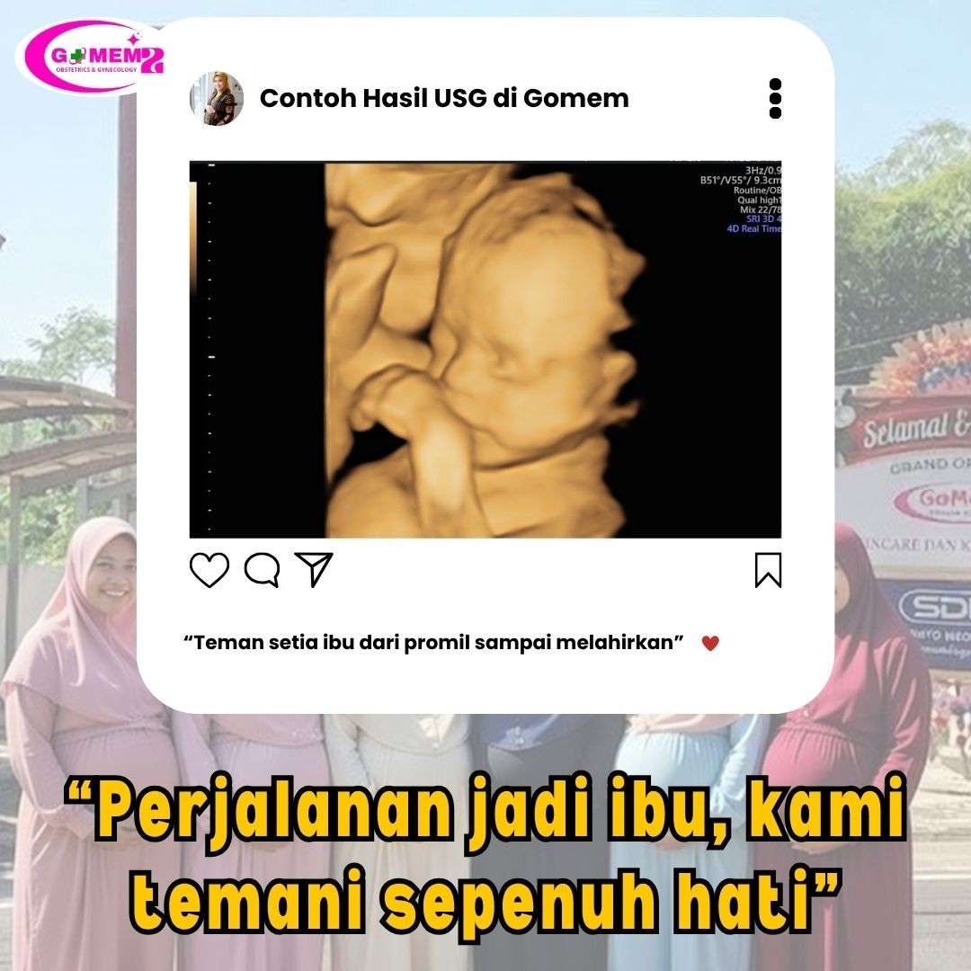 Lepas KB IUD dekat Purwokerto Timur yang Nyaman