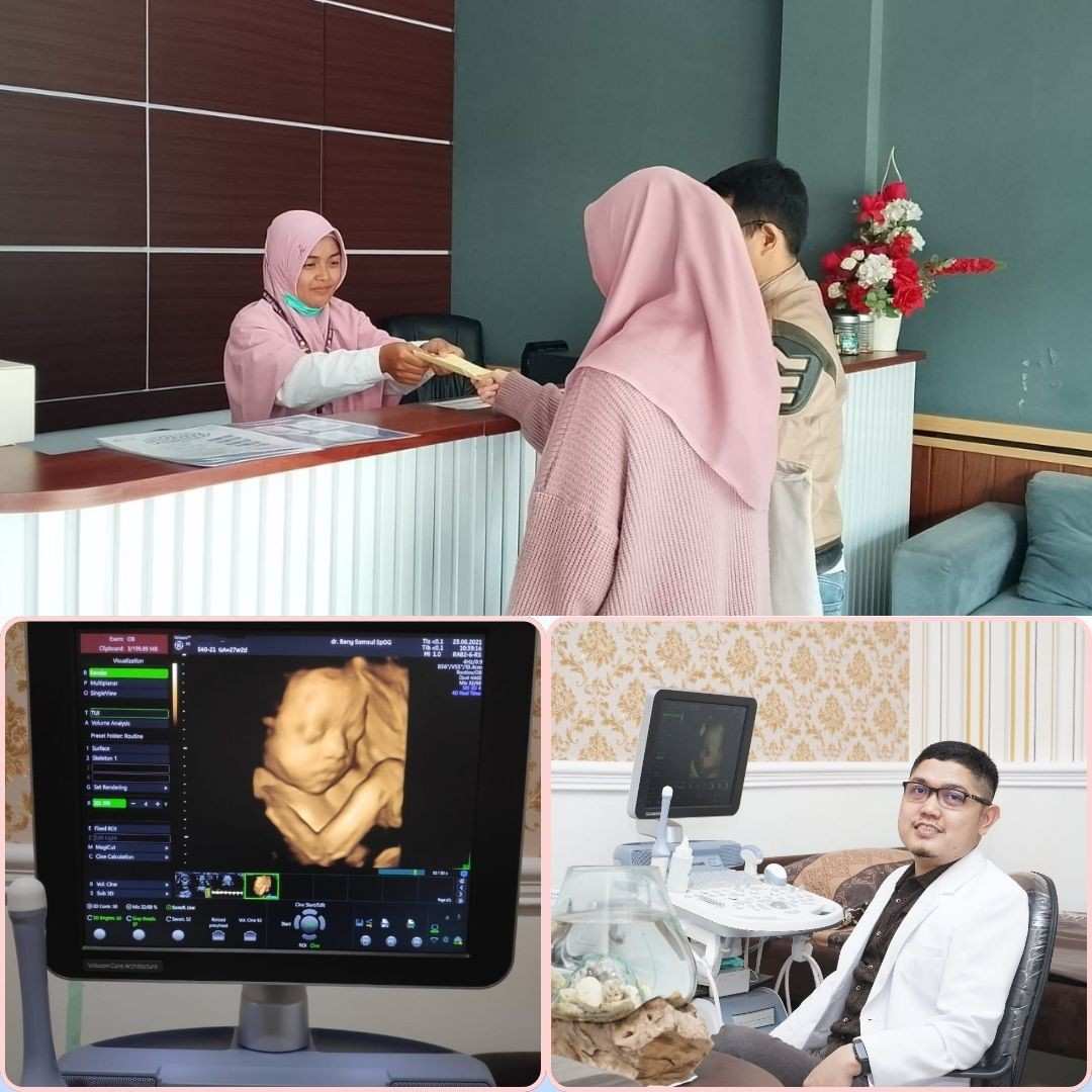 Momen Pertama Lihat Detak Jantung Bayi Lewat USG
