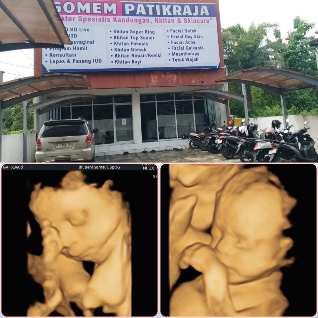 Tempat USG Favorit Ibu Hamil sekitar Wangon