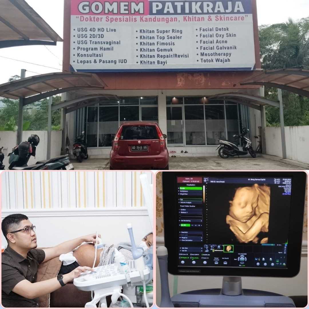USG dengan Hasil Lebih Jelas dekat Sokaraja