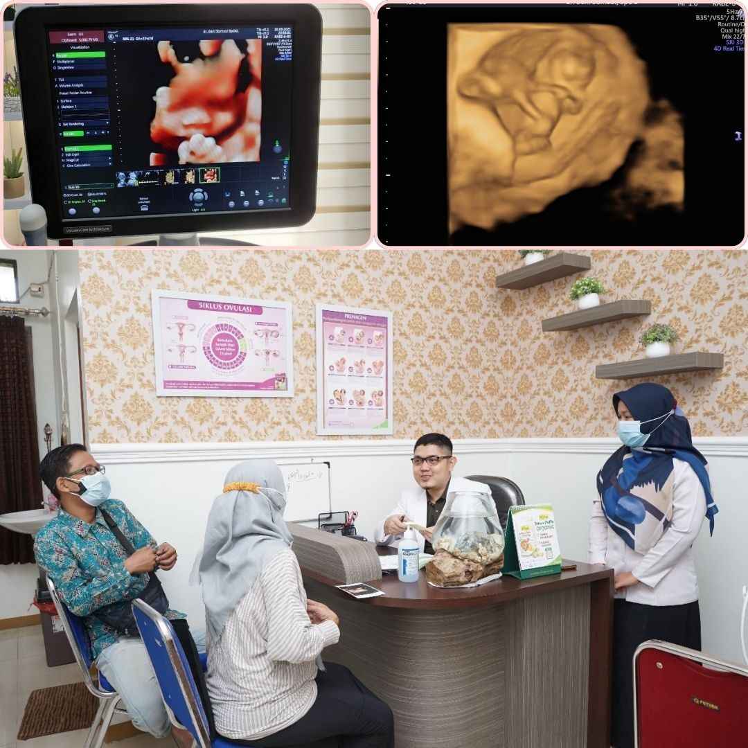USG dengan Pelayanan Ramah dekat Cilongok