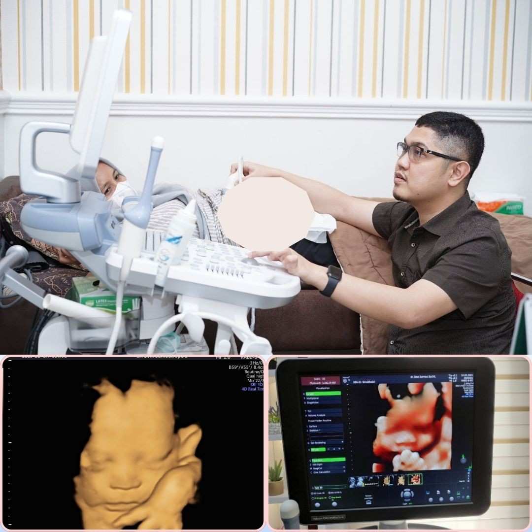 Waktu Terbaik USG 4D Agar Hasil Lebih Jelas